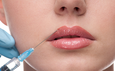 Injection of lip filler to lip of woman